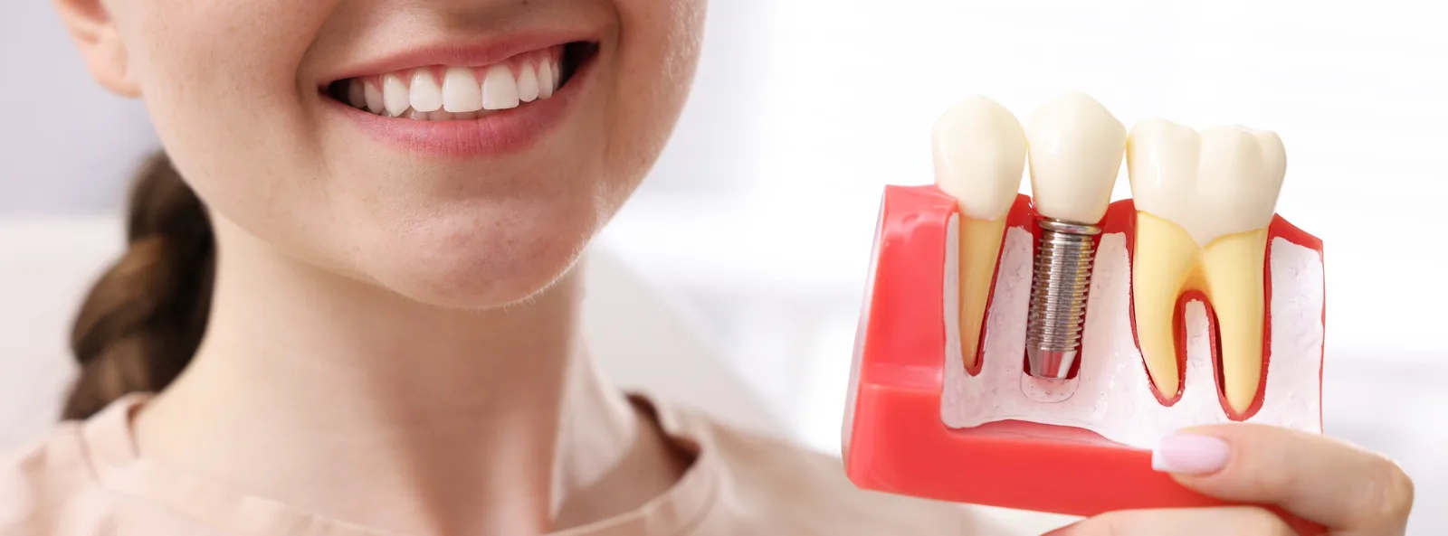 Mujer sonriente sosteniendo modelo de implante dental