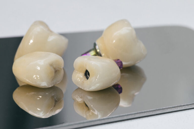 Caries dentales lo que debes saber
